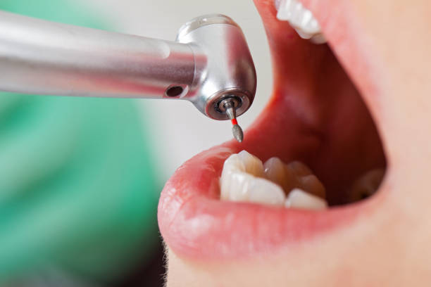 Best Emergency Denture Repair in Tioga Terrace, NY